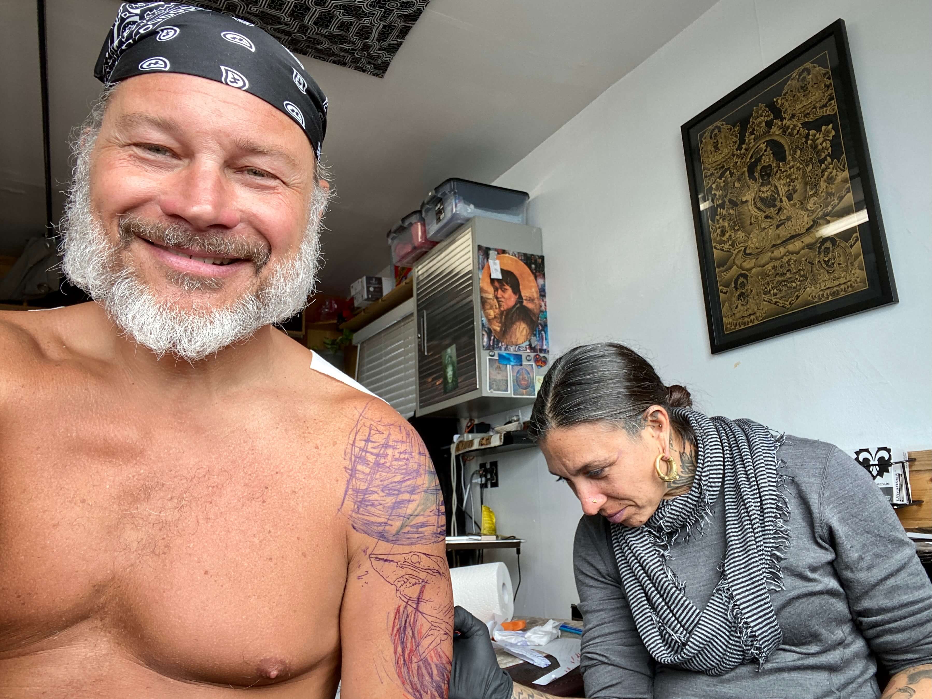Needle Therapy